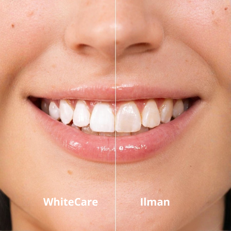 WhiteCare- Hymyä varten, jonka olet aina halunnut näyttää.